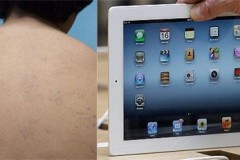 Sử dụng iPad có thể gây dị ứng mẩn đỏ phát ban