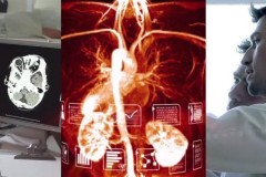 Công nghệ phát hiện ung thư phổi bằng cách đo nhiệt độ hơi thở