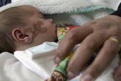 Tại sao em bé khi sinh ra đã có bớt hay đánh dấu trên người?