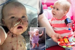 Cô bé 2 tuổi bị cụt tay chân tìm lại nụ cười nhờ món quà đặc biệt