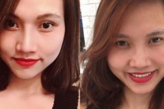 Bị nhà chồng chê xấu, mẹ một con đi phẫu thuật thẩm mỹ 'lột xác' thành hot girl