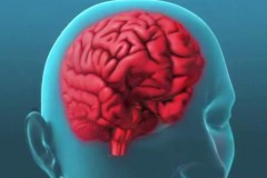 Nghiên cứu nguyên nhân gây ra chứng đau nửa đầu và tìm thuốc đặc trị căn bệnh này