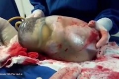 Video: Khoảnh khắc hiếm gặp khi bé sơ sinh chào đời trong màng ối