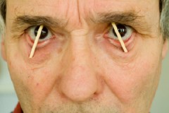 Bí ẩn 40 năm không ngủ của người đàn ông bị đạn bắn xuyên đầu