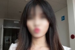 Cô gái xinh đẹp bị bỏng nặng: ‘Sợ cụt hết tay, thành dị dạng không ai dám đến gần’