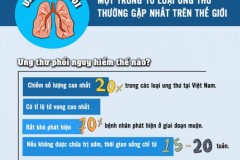 Dấu hiệu giúp chúng ta nhận biết bệnh ung thư phổi