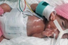Em bé sinh non nhẹ nhất thế giới