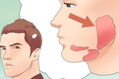 Biện pháp phòng và điều trị bệnh quai bị hiệu quả