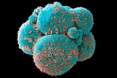 Các nhà khoa học đã tạo ra tế bào trứng hoàn chỉnh từ tế bào da, bệnh vô sinh có thể sẽ bị xóa sổ trong tương lai gần