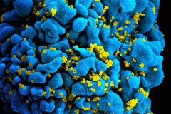 Người đàn ông Anh có thể là người đầu tiên được chữa khỏi HIV nhờ liệu pháp mới