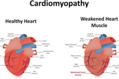 Tác dụng phụ của chế độ ăn ít tinh bột