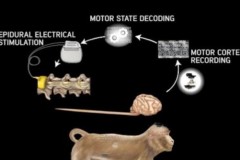 Bệnh nhân bị liệt có thể cử động được nhờ "điều khiển từ xa"