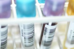 Israel tìm ra loại protein giảm 97% virus HIV sau 8 ngày