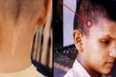 Vết bớt là vết thương từ kiếp trước? Kết luận kinh ngạc của chuyên gia nghiên cứu luân hồi