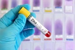 5% phụ nữ mang thai ở Hoa Kỳ dương tính với  vi rút Zika