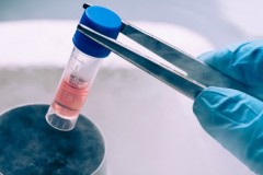 FDA sắp phê duyệt liệu pháp điều trị ung thư tuyệt vời, hiệu quả trên 80%