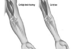 Các nhà khoa học Mỹ: Công nghệ chỉnh sửa gen có thể chữa 15.000 loại bệnh