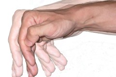 8 triệu chứng cảnh báo bạn có thể bị Parkinson dễ bỏ qua