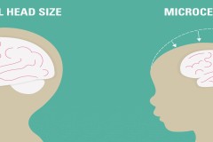 Não nhân tạo - một bước tiến mới trong nghiên cứu virus Zika
