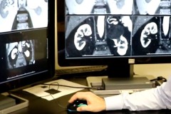 Kỹ thuật MRI tiên tiến sẽ giúp xác định khối u ung thư mà không cần sinh thiết