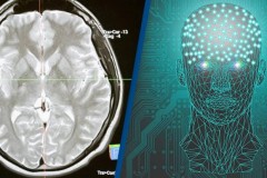 Lần đầu tiên, các nhà khoa học có thể dùng não người kết nối không dây với máy tính