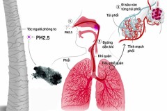 MG Việt Nam trang bị thêm hệ thống lọc không khí có tính năng lọc bụi mịn PM 2.5