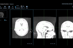 Tiến sĩ tạo phần mềm AI chẩn đoán bệnh Alzheimer trong 10 phút
