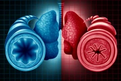 Phát hiện mới trong nghiên cứu điều trị bệnh hen suyễn