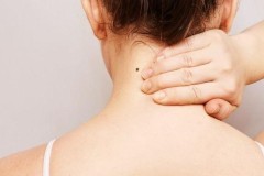 Nốt ruồi sau gáy có ý nghĩa gì? Là điềm báo tốt hay xấu?