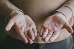 Nốt ruồi trong lòng bàn tay có ý nghĩa gì? Là điềm báo tốt hay xấu?