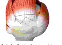 Smith+Nephew completes acquisition of Integrity Orthopaedics; establishes unrivalled portfolio for shoulder repair