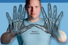 Công nghệ cấy các thiết bị trực tiếp vào cơ thể người