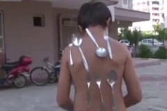 Cậu bé 9 tuổi biến thành "cục nam châm" mỗi khi tức giận