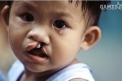 Ban điều hành game VLTK-CTC khuyến khích game thủ làm từ thiện vì trẻ em hở hàm ếch