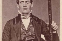 Bí ẩn trong não của một người bị đâm xuyên đầu