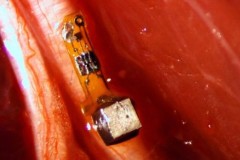 Bụi thông minh - Cảm biến siêu nhỏ cấy vào não, giám sát theo thời gian thực