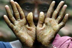 Thế giới đang “kêu trời” vì nguồn nước ô nhiễm chưa từng thấy