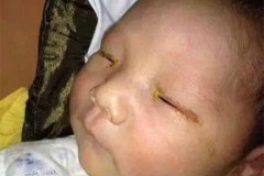 Đèn flash có thể gây mù mắt trẻ sơ sinh hay không?