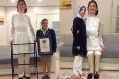 Cuộc sống gắn liền với xe lăn của cô gái cao nhất thế giới