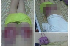 Đau lòng trước bé trai bị bố đánh mông rướm máu vì bỏ học đi chơi game