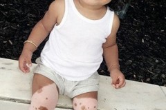 Bé gái vừa sinh ra đã có “chỏm tóc bạc” trên đầu