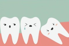 Loại bỏ suy nghĩ sai lầm về việc nhổ răng khôn