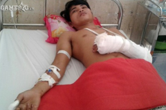 Chủ quán net bị chém cụt tay vì ngăn cản thanh niên xem phim đồi trụy