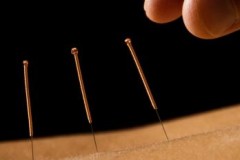 [Nghiên cứu] Châm cứu có thể làm gia tăng lưu lượng máu, thanh lọc cơ thể?