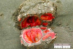 Ngỡ ngàng khi bị cắt ra “hòn đá” này đột nhiên chảy máu