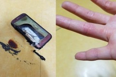 Galaxy S7 bất ngờ phát nổ gây bỏng tay người dùng