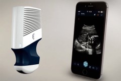 Các tiến bộ mới giúp việc siêu âm dễ dàng hơn