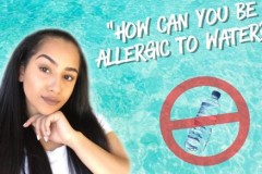 Con người có thể bị dị ứng với nước hay không?