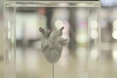 “Life Before Ashes” – Chiến dịch về hiến tạng ở Ấn Độ