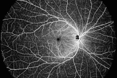 Công nghệ chẩn đoán hình ảnh nguồn quét tiên tiến DREAM OCT™ của Intalight™ được cấp chứng nhận CE